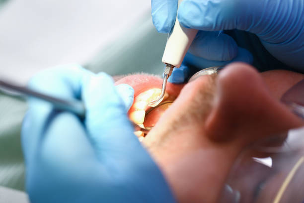 Best Emergency Dentist for Knocked-Out Tooth in Santa Teresa, NM